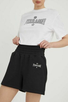 Bombažne kratke hlače Chiara Ferragni črna barva - črna. Kratke hlače iz kolekcije Chiara Ferragni