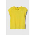 Otroška kratka majica Tommy Hilfiger rumena barva - rumena. Otroške kratka majica iz kolekcije Tommy Hilfiger. Model izdelan iz tanke, elastične pletenine. Model iz izjemno udobne tkanine z visoko vsebnostjo bombaža.