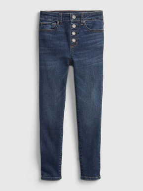 Gap Otroške Jeans hlače kids high-rise distressed ankle jeggings with washwell 8