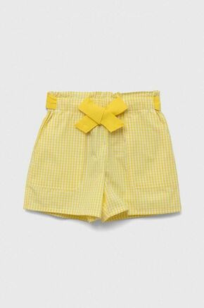 Otroške bombažne kratke hlače United Colors of Benetton rumena barva - rumena. Otroški kratke hlače iz kolekcije United Colors of Benetton. Model izdelan iz lahkega blaga. Model iz izjemno udobne bombažne tkanine.