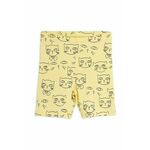 Otroške kratke hlače Mini Rodini rumena barva - rumena. Otroški kratke hlače iz kolekcije Mini Rodini. Model izdelan iz vzorčaste pletenine.